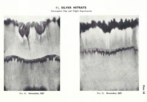 Silver Nitrate