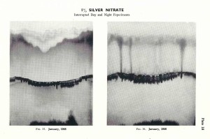 Silver Nitrate