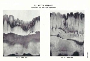 Silver Nitrate