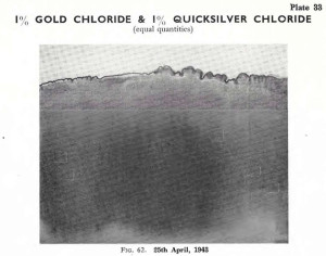 Plate 33, Fig. 62, 1% Gold chloride and 1% Quicksilver chloride